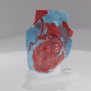 This model depicts a heart with a persistent superior left vena cava.