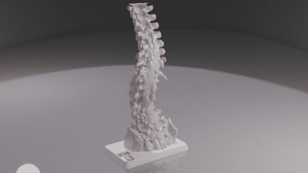 A 3D printed anatomical model of a spine with scoliosis