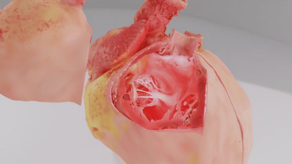 A 3D printed anatomical model of a heart