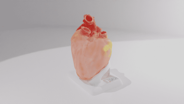 An anatomical model of a heart