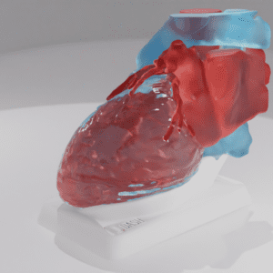 This model depicts a heart with a Left Atrial Appendage, with the "Swan" variation.