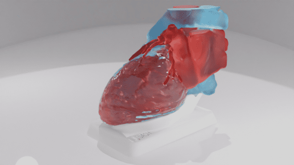 This model depicts a heart with a Left Atrial Appendage, with the "Swan" variation.