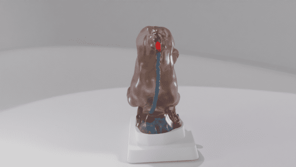 An anatomical model of spina bifida myeloschisis