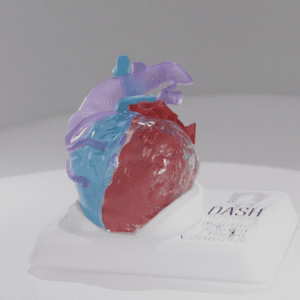 A heart model with a double outlet right ventricle defect