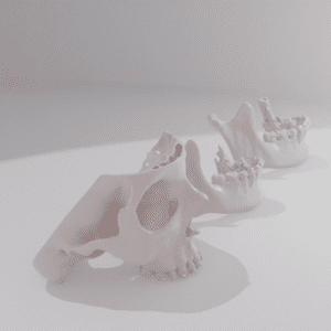 Craniomaxillofacial