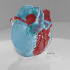 A reference model of a heart with tetralogy of fallot.
