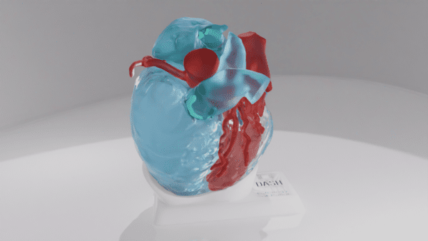 A reference model of a heart with tetralogy of fallot.