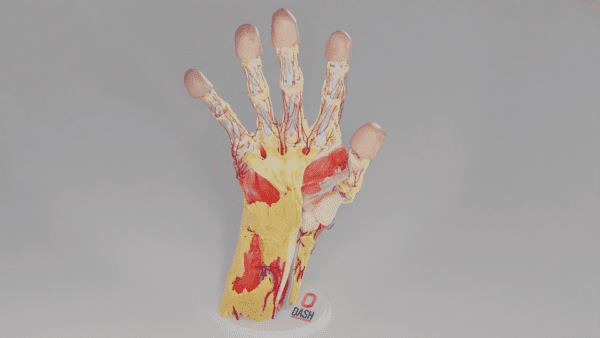 A hand model with the skin cut away to show interior tissues