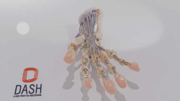 A hand model with the soft tissue cut away to show interior skeletal and tendon structure