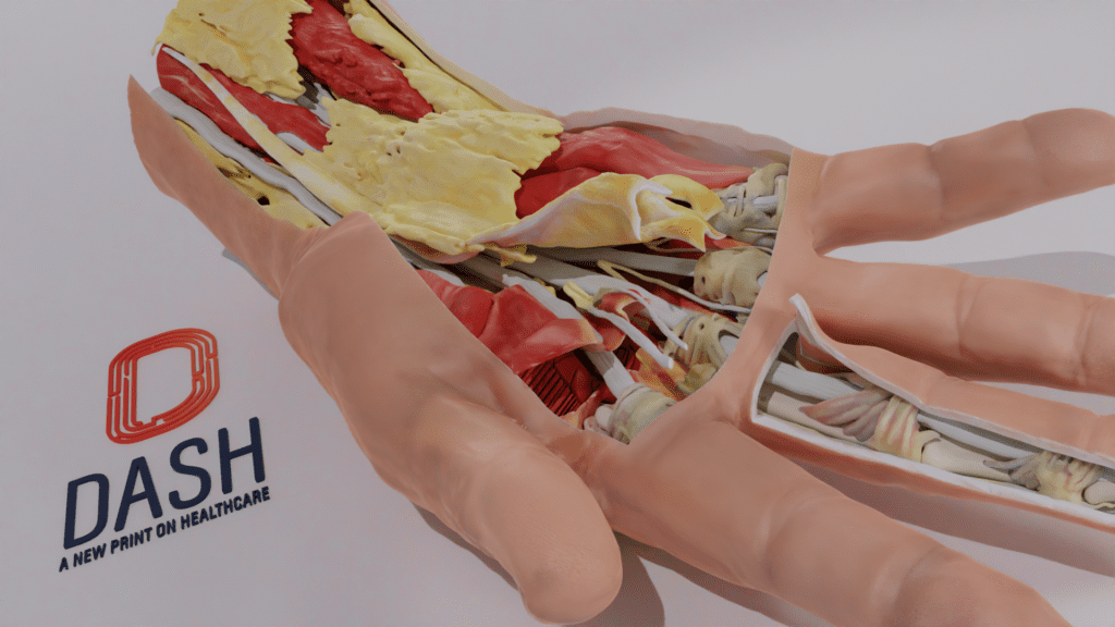 Dissectable Hand Anatomical Model - DASH 3D
